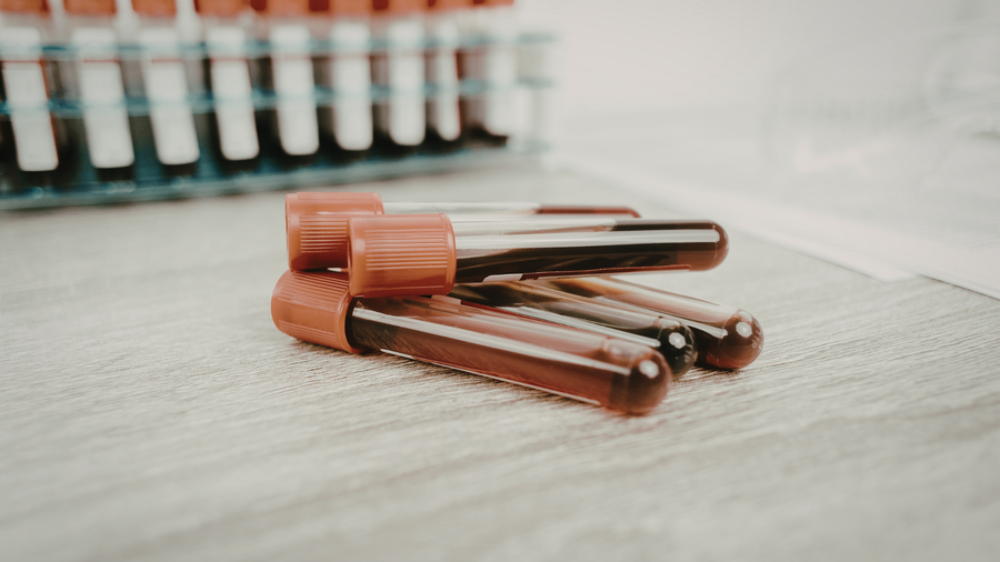 ApoB: The Heart Health Marker More People Should Know About