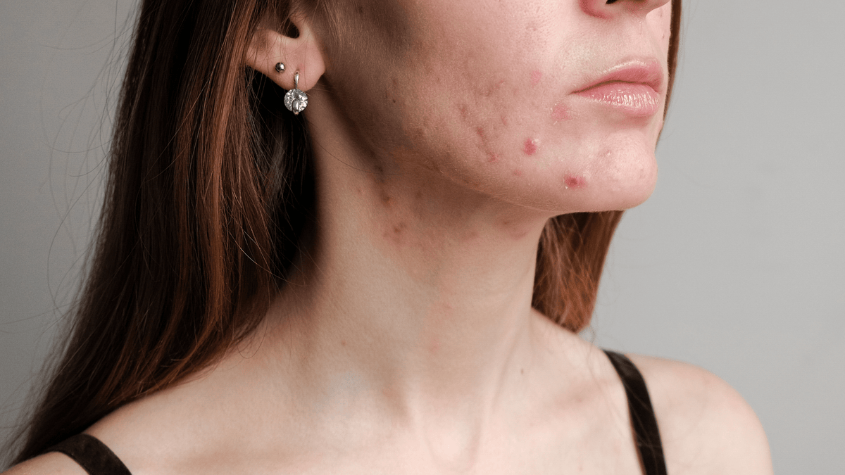 What Your Skin May Be Telling You About What You’re Eating