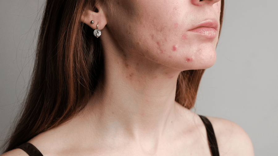 What Your Skin May Be Telling You About What You’re Eating