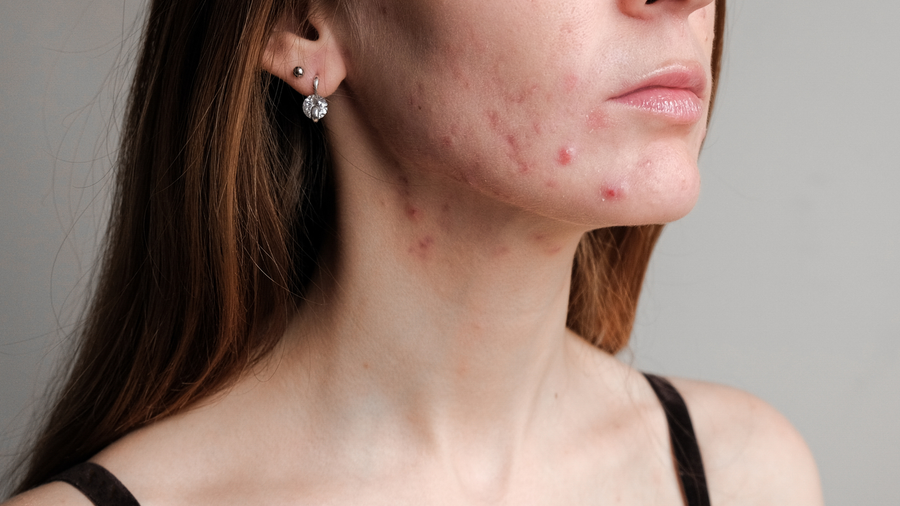 What Your Skin May Be Telling You About What You’re Eating