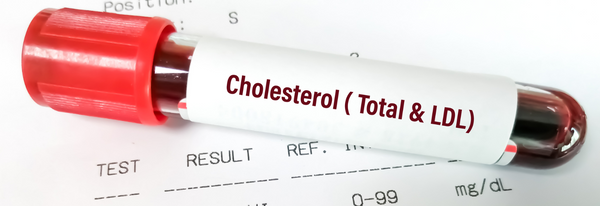The Real Culprit: Saturated Fat and Cholesterol